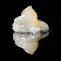 Fresh Frozen Cannabis: How Live Rosin Is Made and Why It Costs So Much